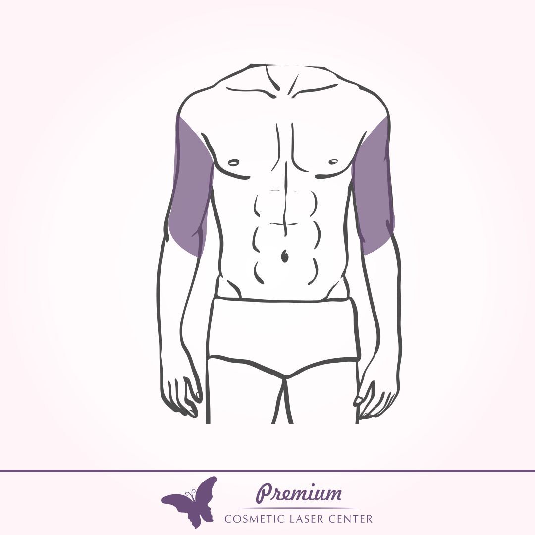 Upper Arms (M)